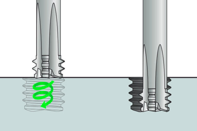 What is the difference between thread whirling and thread milling?